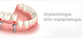 implanty